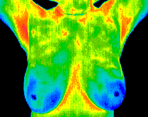 Thermograph.